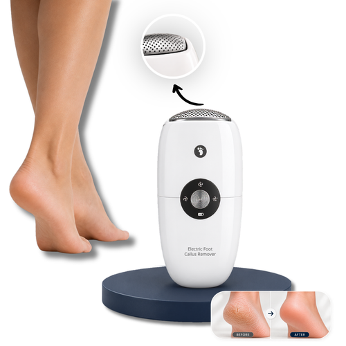 TheDermaDE™ 3-in-1 Electric Callus Remover